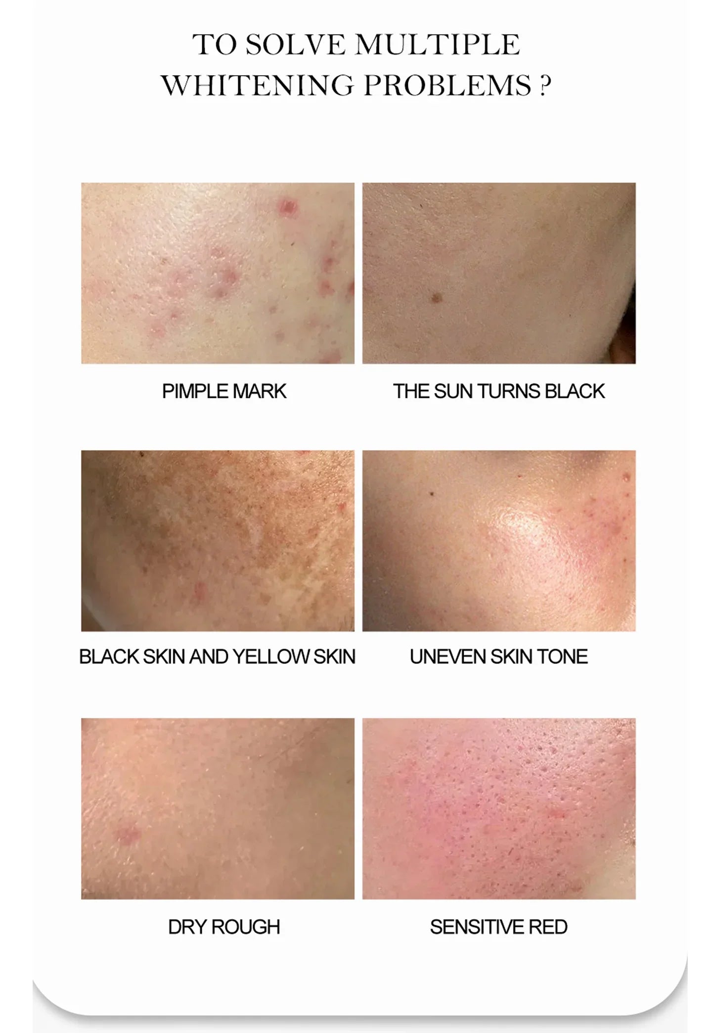Whitening Facial Box (NEW ARRIVAL)